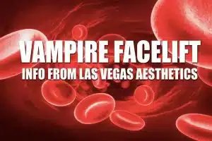 What is a Vampire FaceLift treatment anyway?