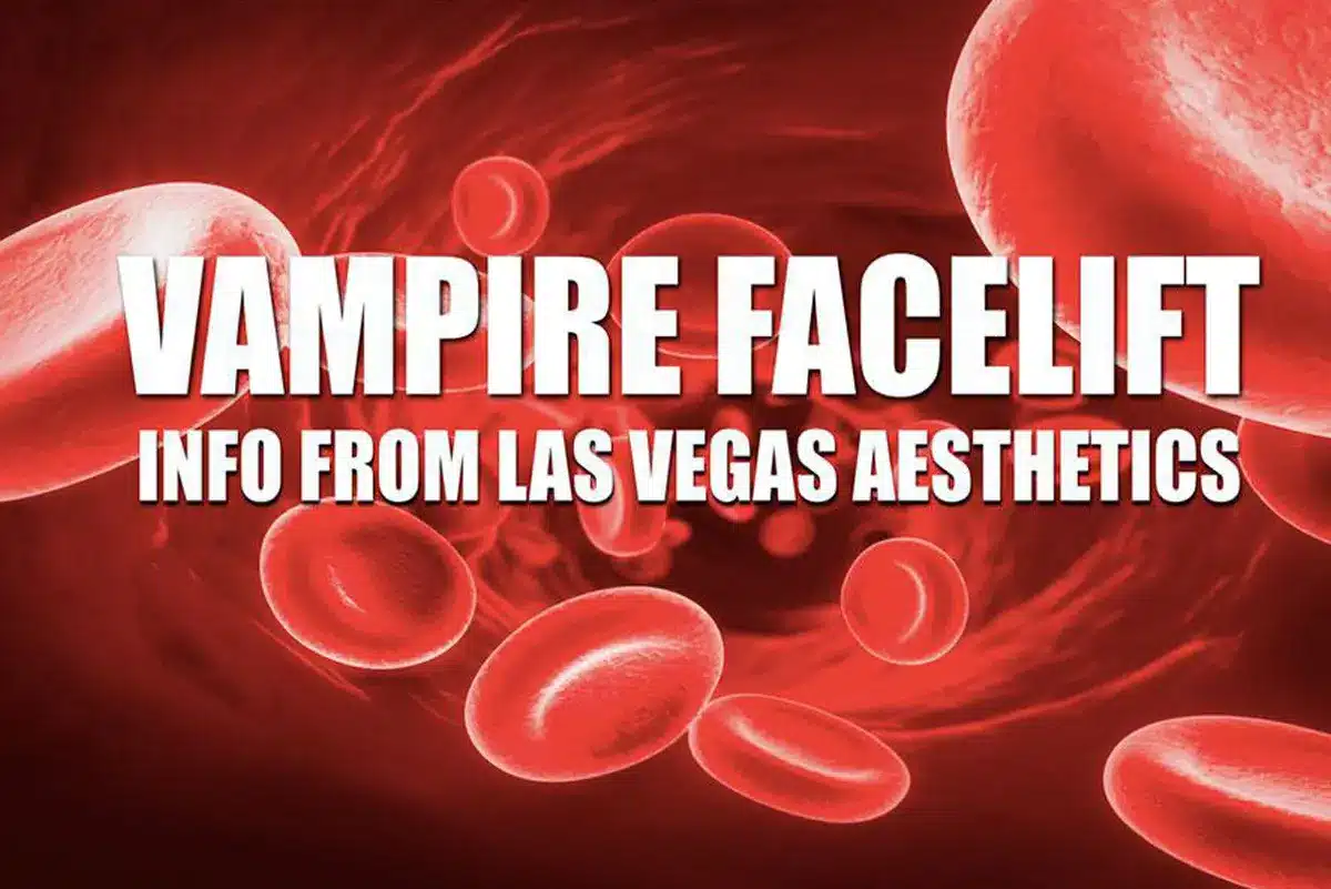 You are currently viewing What is a Vampire FaceLift treatment anyway?
