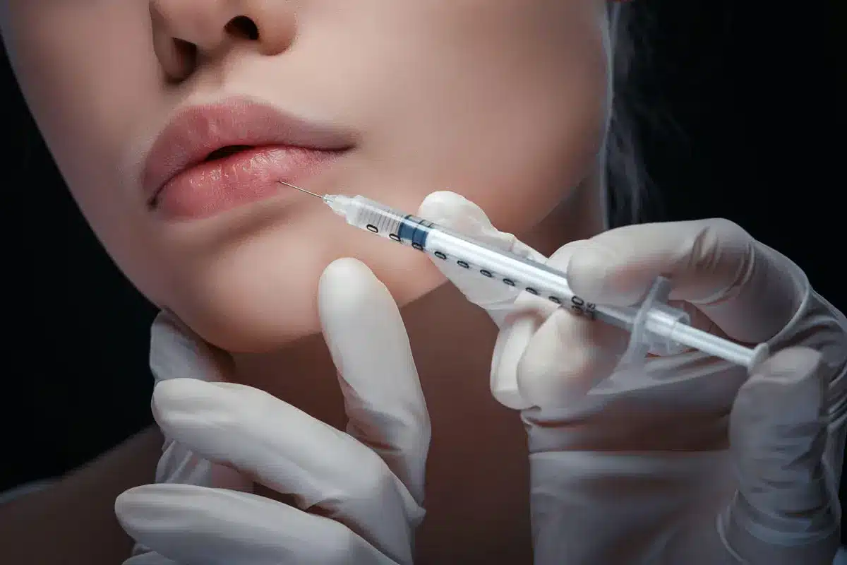 Dermal fillers Las Vegas Restylane Juvederm lip filler facial volume