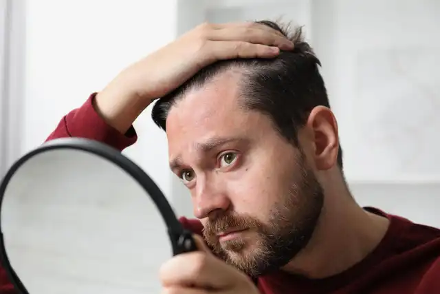 Man examining hair loss in mirror — PRP hair restoration treatment, Las Vegas Aesthetics Thomas Pulice PA-C